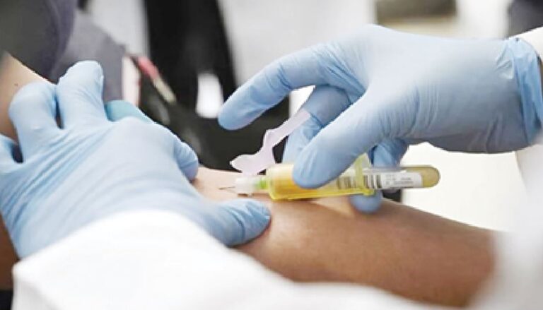 Gwamnatin Nijeriya ta karbi allurar rigakafin cuta mai karya garkuwar jiki wato HIV